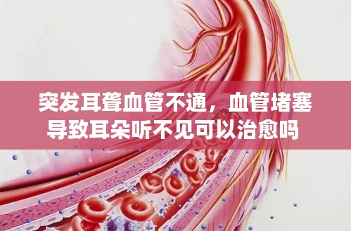 突发耳聋血管不通,血管堵塞导致耳朵听不见可以治愈吗